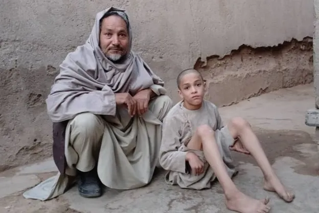 The Heavy Price of Parental Neglect: Polio Victim Muhammad Usman