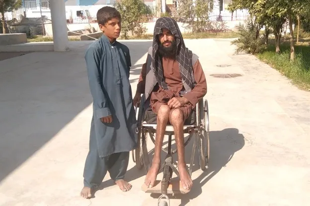 Mohammad Ibrahim: A Living Portrait of Polio's Tragedy