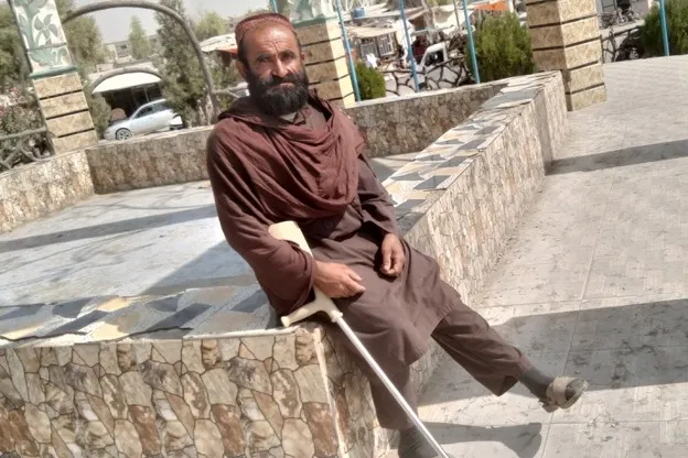 An Affliction That Could Have Been Prevented: Sardar Mohammad's Heartbreaking Life Story